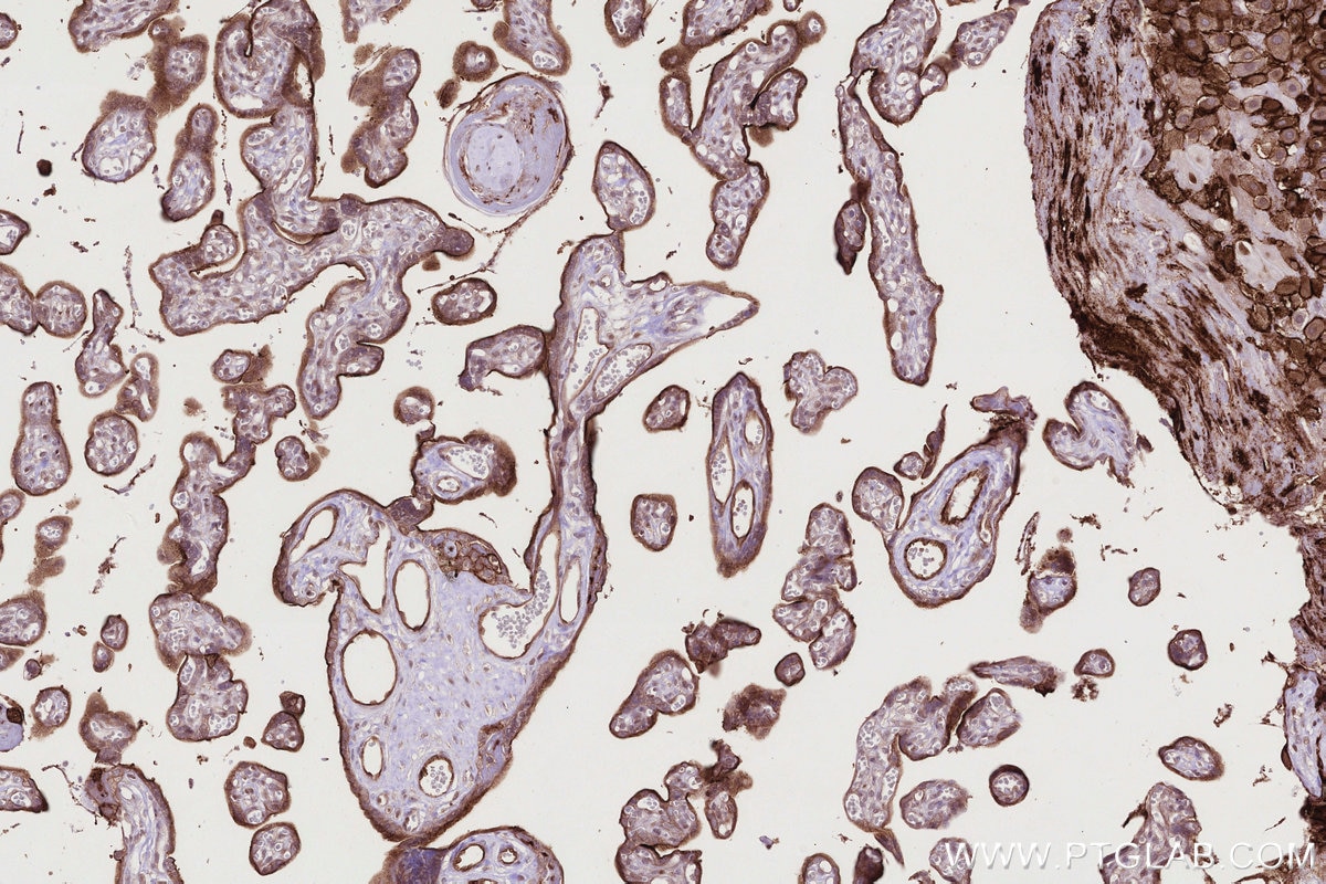 Immunohistochemistry (IHC) staining of human placenta tissue using PGT Recombinant monoclonal antibody (83302-1-RR)