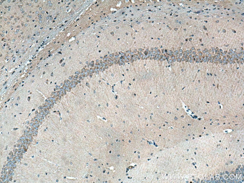 Immunohistochemistry (IHC) staining of mouse brain tissue using PHACTR1 Polyclonal antibody (23446-1-AP)