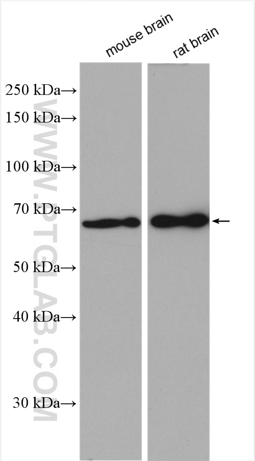 Western Blot (WB) analysis of various lysates using PHACTR1 Polyclonal antibody (23446-1-AP)