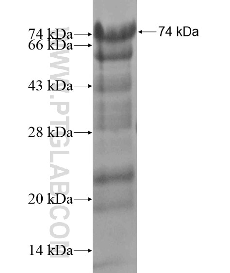 PHACTR1 fusion protein Ag20125 SDS-PAGE