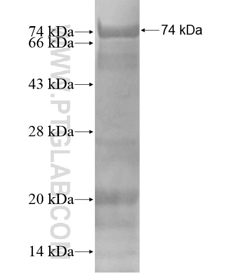 PHACTR2 fusion protein Ag18610 SDS-PAGE