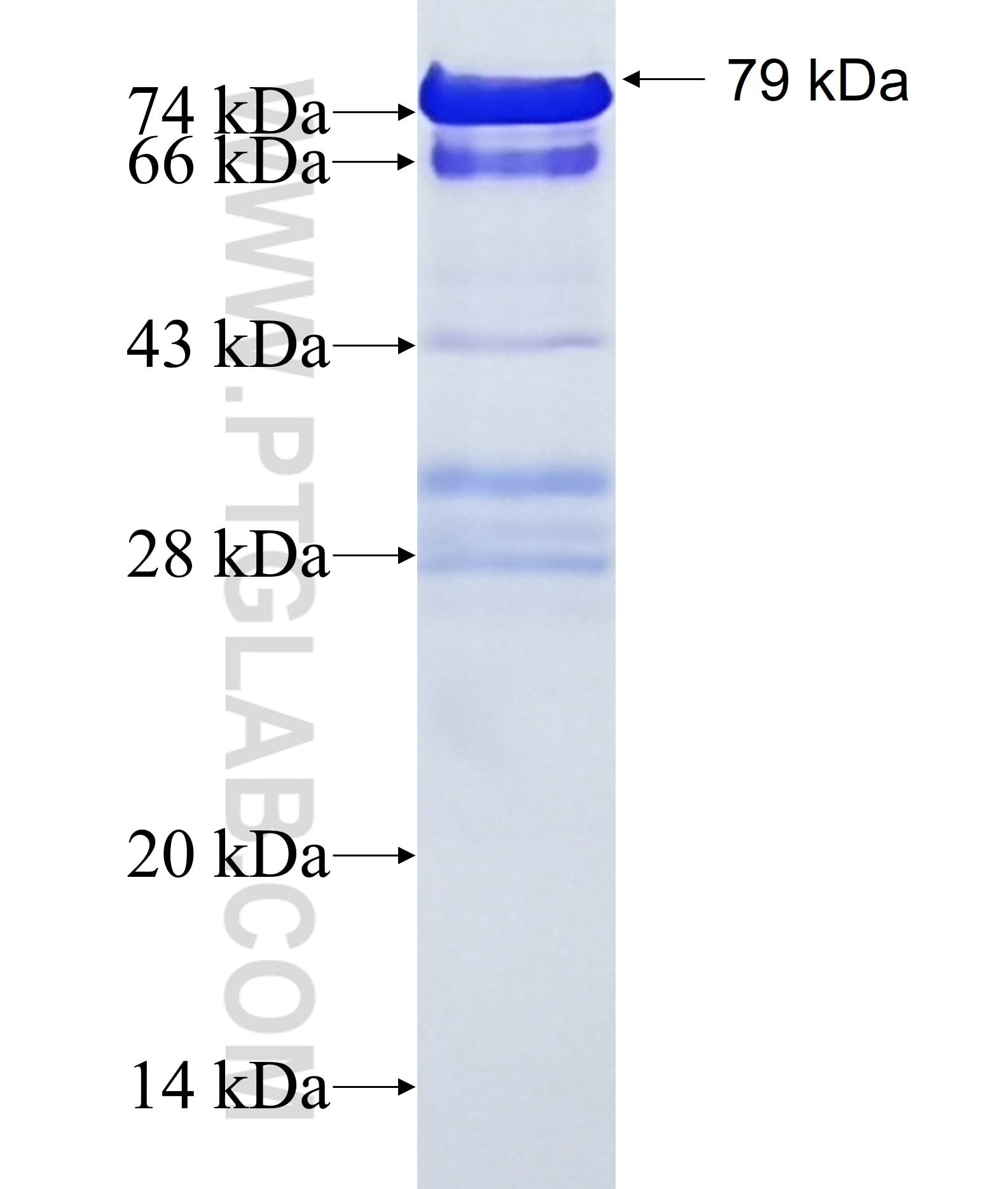 PHACTR2 fusion protein Ag18610 SDS-PAGE