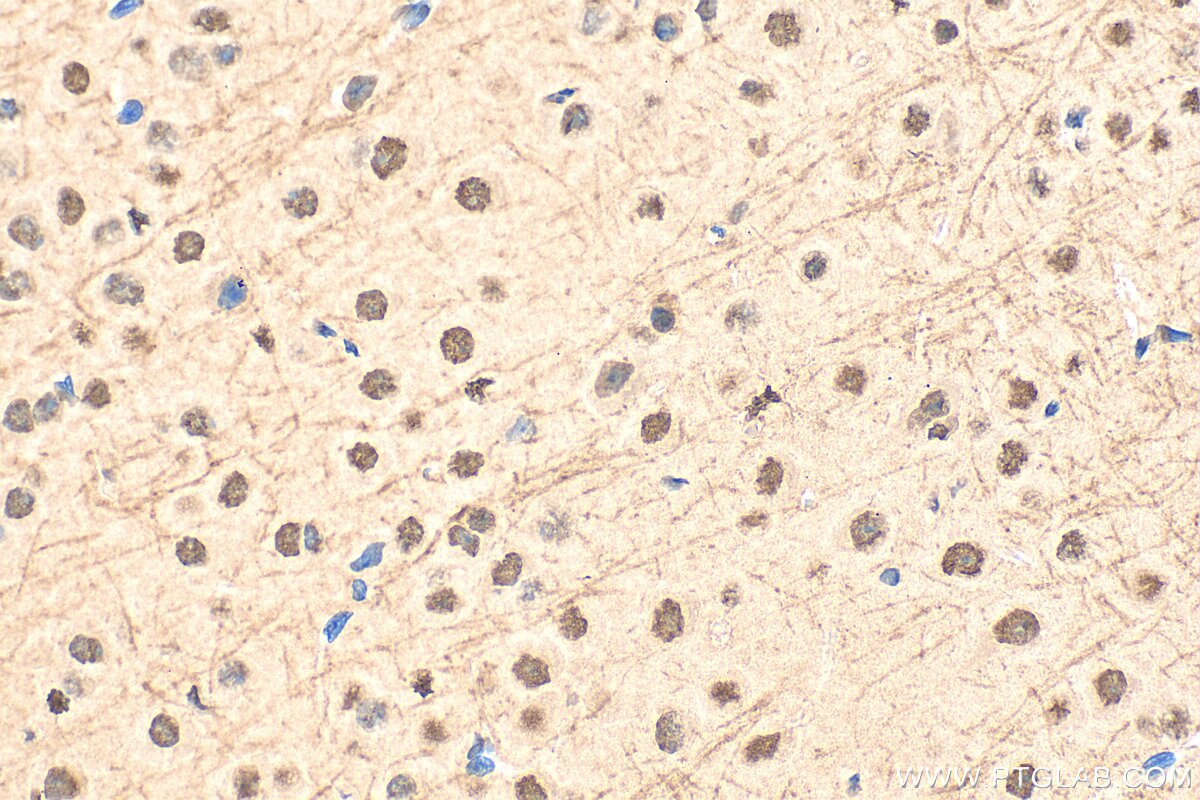 Immunohistochemistry (IHC) staining of mouse brain tissue using PHACTR3 Polyclonal antibody (18107-1-AP)