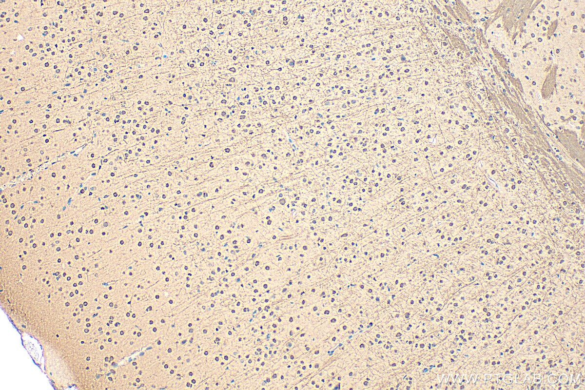 Immunohistochemistry (IHC) staining of mouse brain tissue using PHACTR3 Polyclonal antibody (18107-1-AP)
