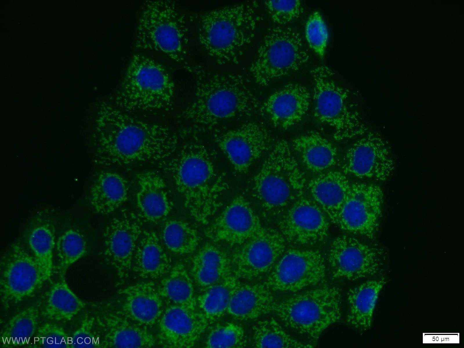 Immunofluorescence (IF) / fluorescent staining of A431 cells using PHACTR4 Polyclonal antibody (13408-1-AP)