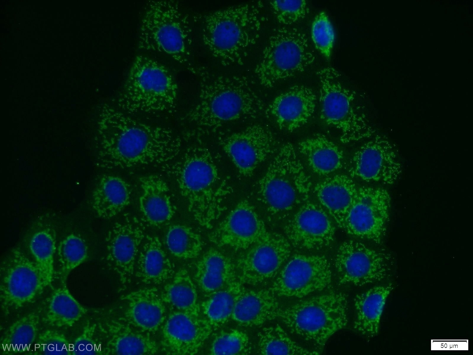 IF Staining of A431 using 13408-1-AP