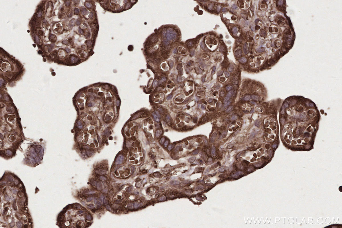 Immunohistochemistry (IHC) staining of human placenta tissue using PHACTR4 Polyclonal antibody (13408-1-AP)