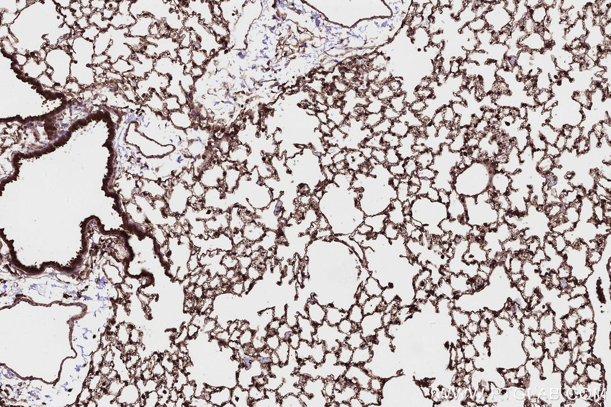 Immunohistochemistry (IHC) staining of mouse lung tissue using PHACTR4 Polyclonal antibody (13408-1-AP)