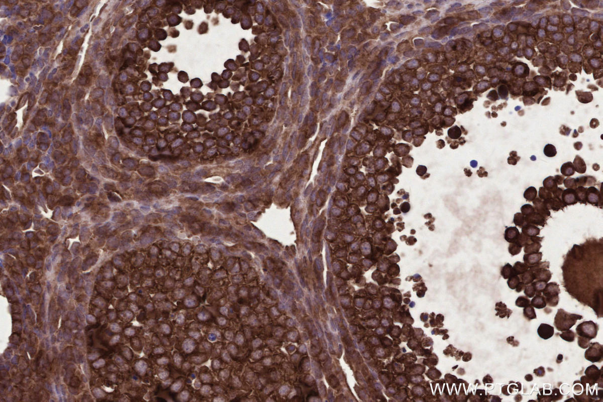 Immunohistochemistry (IHC) staining of mouse ovary tissue using PHACTR4 Polyclonal antibody (13408-1-AP)