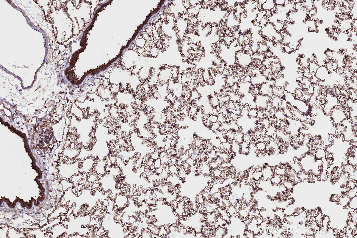 Immunohistochemistry (IHC) staining of rat lung tissue using PHACTR4 Polyclonal antibody (13408-1-AP)