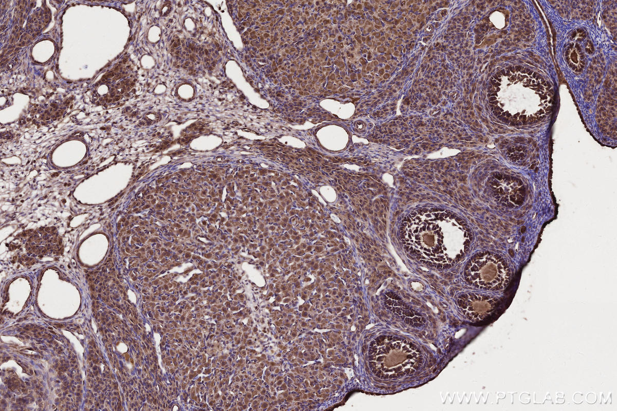 Immunohistochemistry (IHC) staining of rat ovary tissue using PHACTR4 Polyclonal antibody (13408-1-AP)