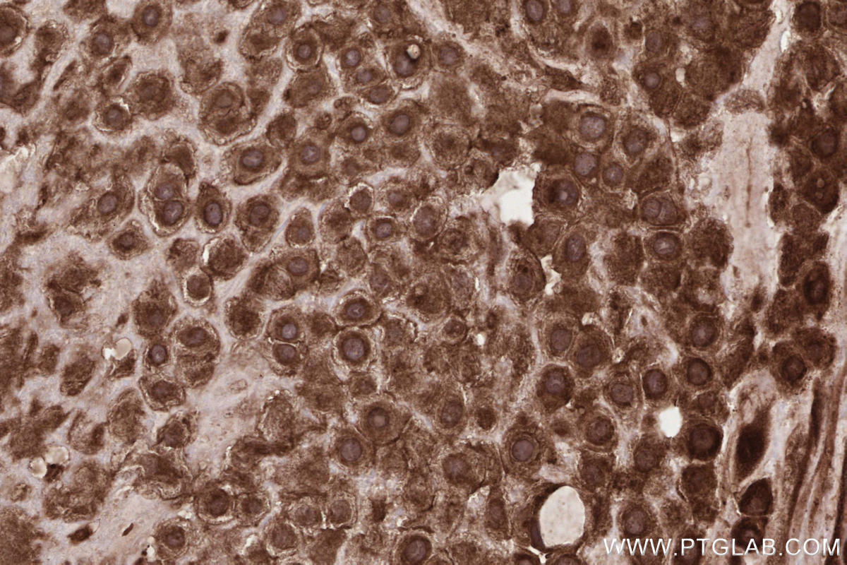 Immunohistochemistry (IHC) staining of human placenta tissue using PHACTR4 Polyclonal antibody (13408-1-AP)
