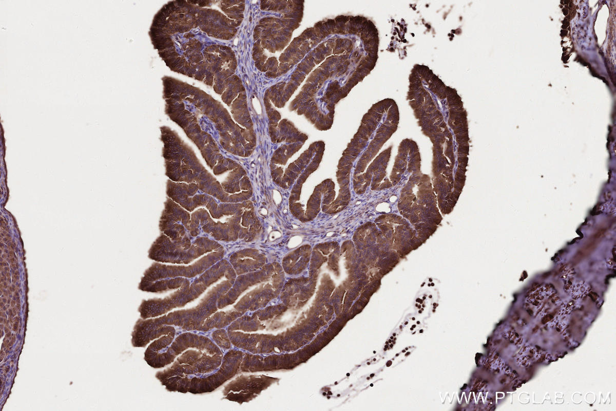 Immunohistochemistry (IHC) staining of rat ovary tissue using PHACTR4 Polyclonal antibody (13408-1-AP)
