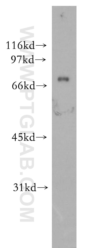 Western Blot (WB) analysis of human liver tissue using PHACTR4 Polyclonal antibody (13408-1-AP)