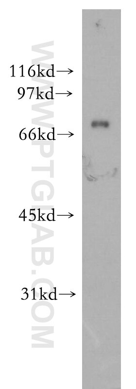 WB analysis of human liver using 13408-1-AP