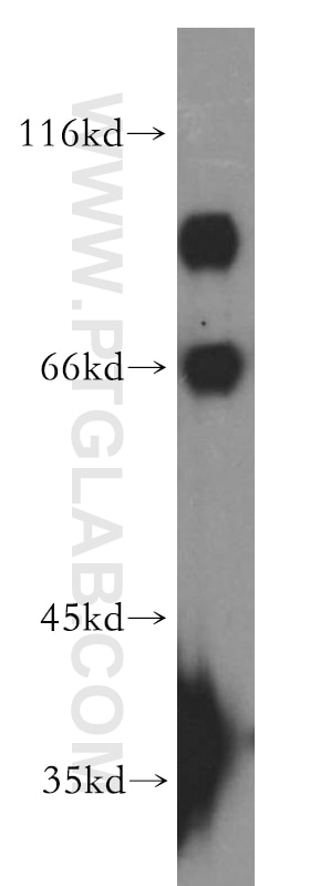 Western Blot (WB) analysis of A431 cells using PHACTR4 Polyclonal antibody (13408-1-AP)