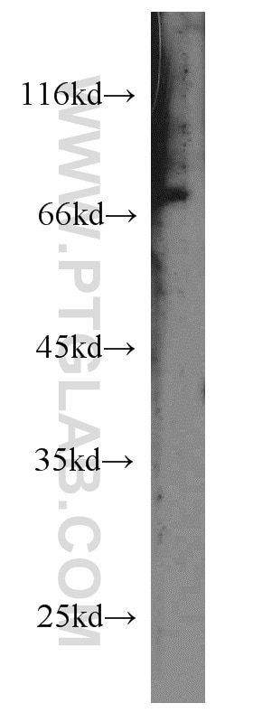 Western Blot (WB) analysis of mouse eye tissue using PHACTR4 Polyclonal antibody (13408-1-AP)