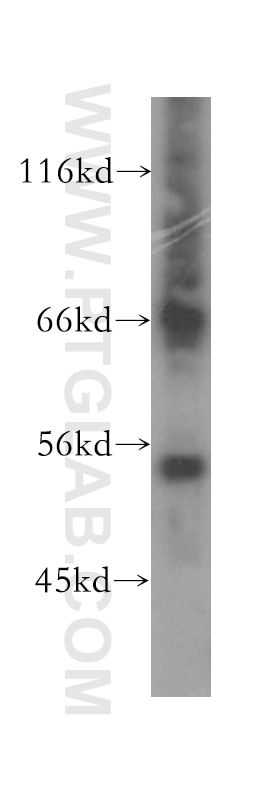 Western Blot (WB) analysis of HepG2 cells using PHAX Polyclonal antibody (16481-1-AP)