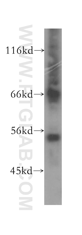 WB analysis of HepG2 using 16481-1-AP