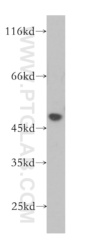 Western Blot (WB) analysis of HeLa cells using PHAX Polyclonal antibody (16481-1-AP)