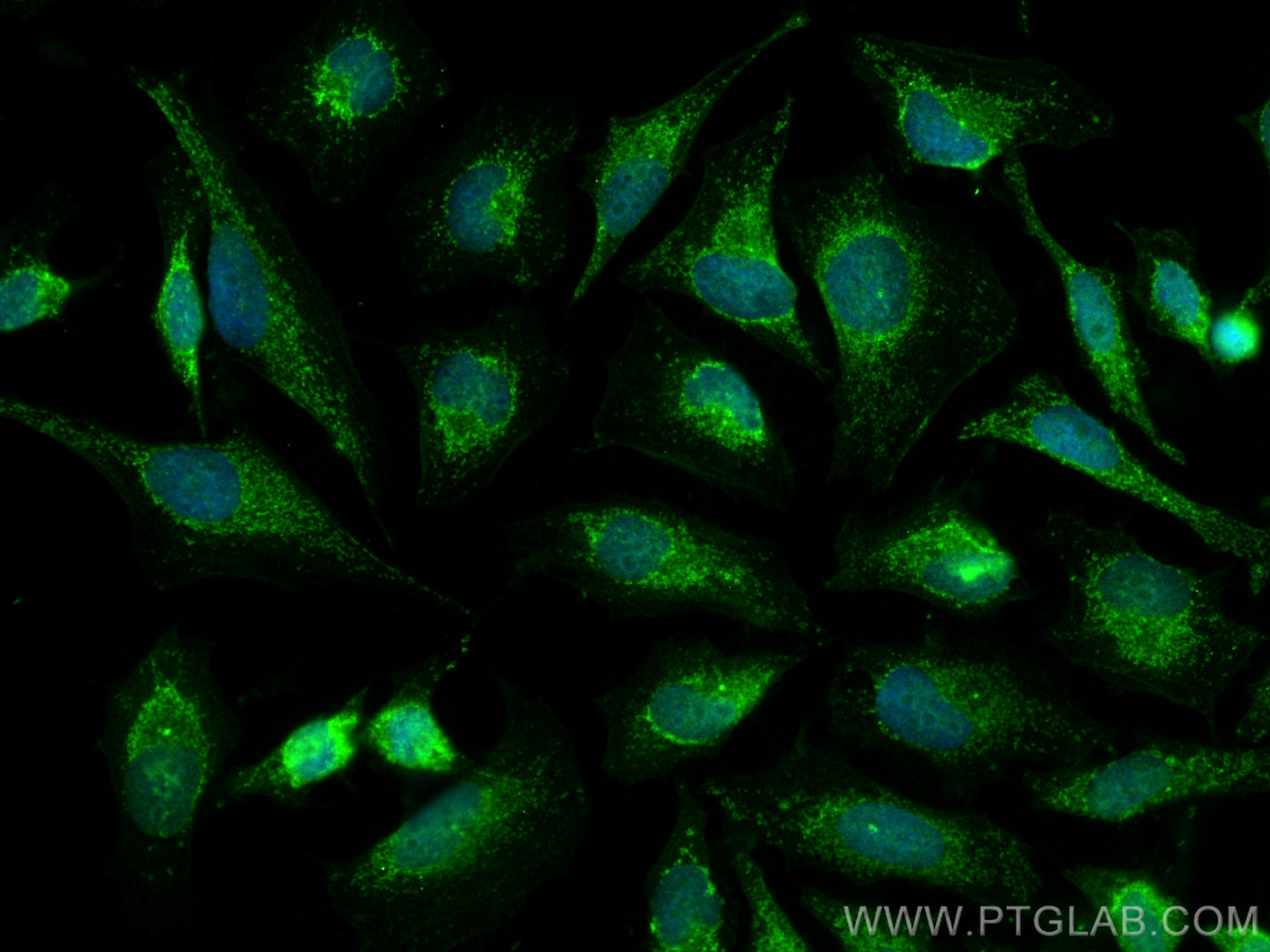 Immunofluorescence (IF) / fluorescent staining of HeLa cells using Prohibitin Polyclonal antibody (10787-1-AP)