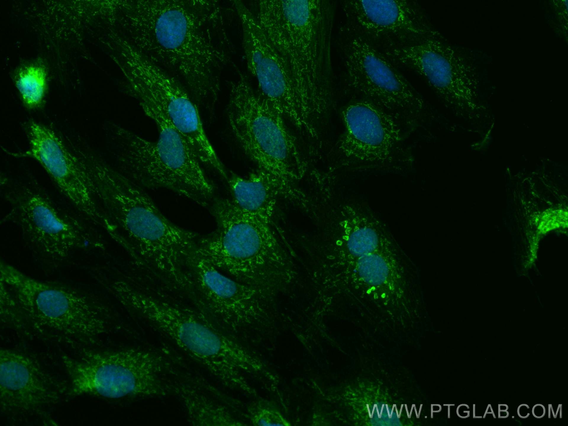 Immunofluorescence (IF) / fluorescent staining of H9C2 cells using Prohibitin Polyclonal antibody (10787-1-AP)