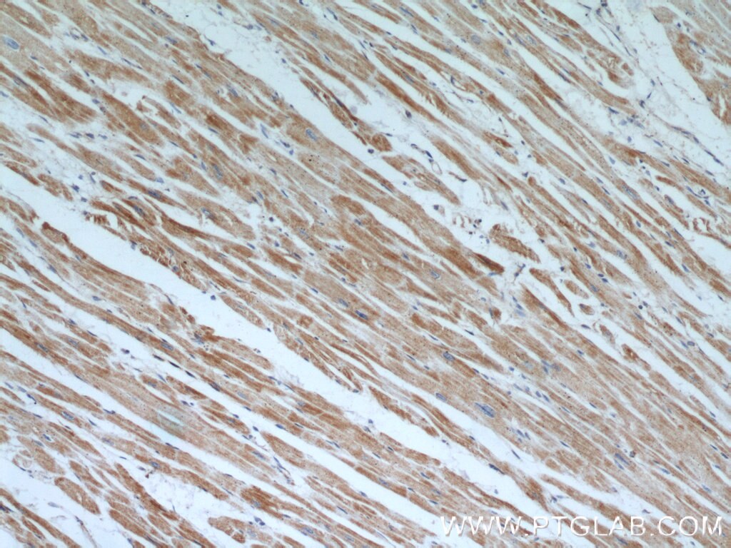 Immunohistochemistry (IHC) staining of human heart tissue using Prohibitin Polyclonal antibody (10787-1-AP)