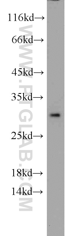 Western Blot (WB) analysis of human liver tissue using Prohibitin Polyclonal antibody (10787-1-AP)