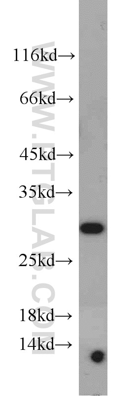 Western Blot (WB) analysis of human brain tissue using Prohibitin Polyclonal antibody (10787-1-AP)