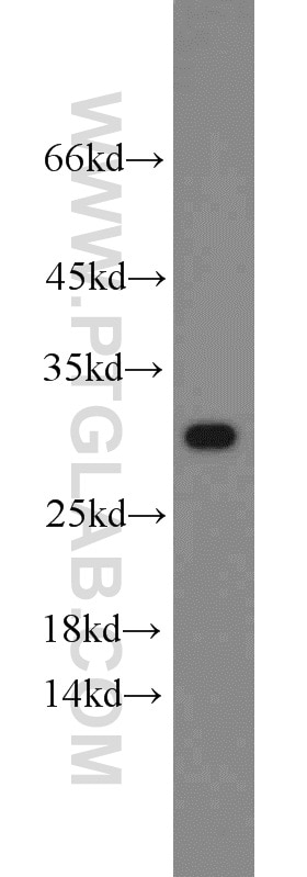 WB analysis of HeLa using 10787-1-AP