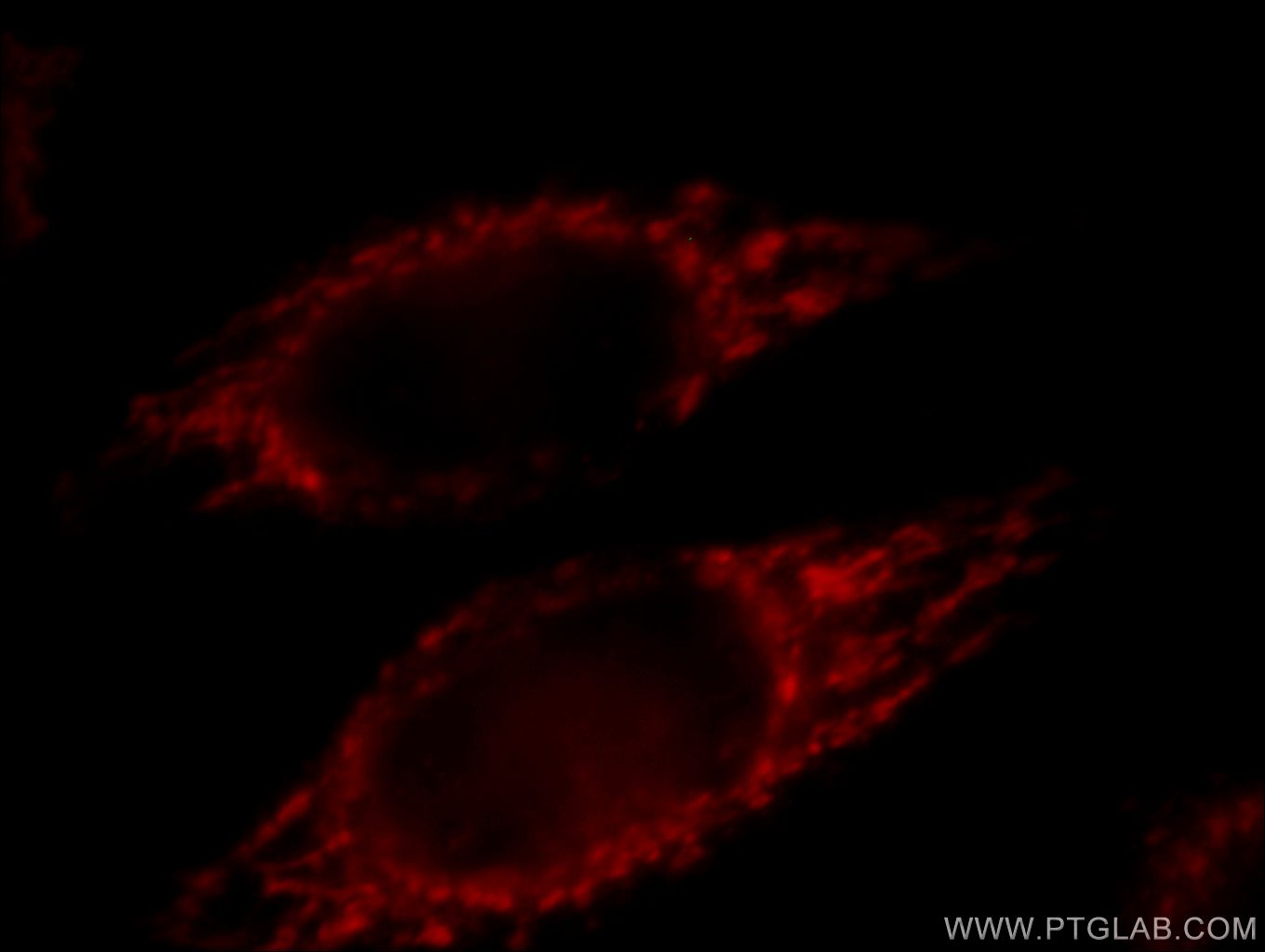 IF Staining of HeLa using 60092-1-Ig