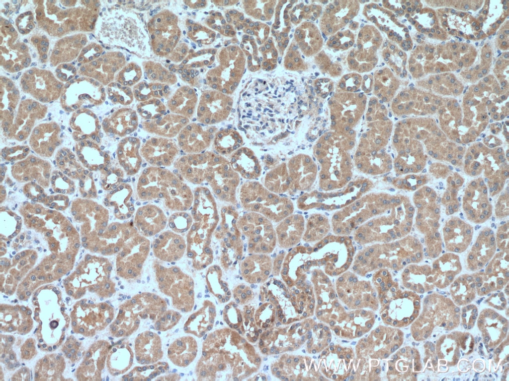 Immunohistochemistry (IHC) staining of human kidney tissue using Prohibitin Monoclonal antibody (60092-1-Ig)