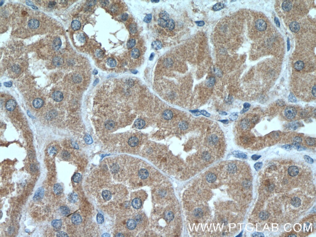 Immunohistochemistry (IHC) staining of human kidney tissue using Prohibitin Monoclonal antibody (60092-1-Ig)