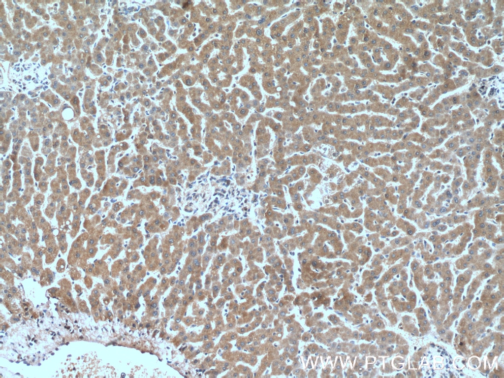 Immunohistochemistry (IHC) staining of human liver tissue using Prohibitin Monoclonal antibody (60092-1-Ig)