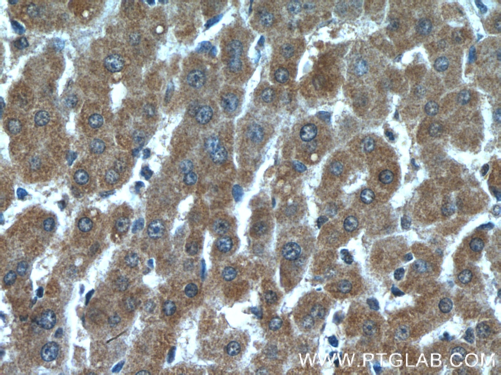 Immunohistochemistry (IHC) staining of human liver tissue using Prohibitin Monoclonal antibody (60092-1-Ig)