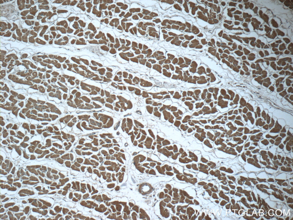 Immunohistochemistry (IHC) staining of human heart tissue using Prohibitin Monoclonal antibody (60092-1-Ig)