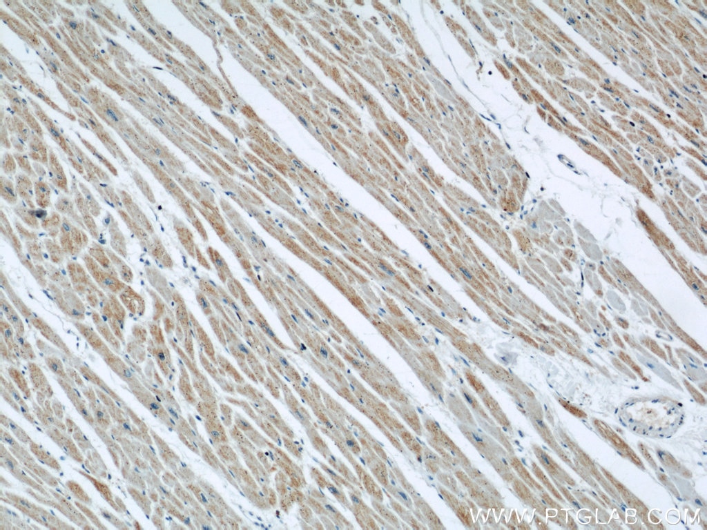 Immunohistochemistry (IHC) staining of human heart tissue using Prohibitin Monoclonal antibody (60092-1-Ig)