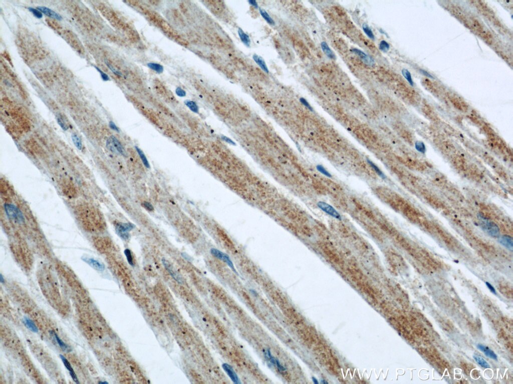 IHC staining of human heart using 60092-1-Ig