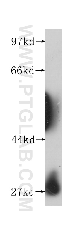 Western Blot (WB) analysis of human placenta tissue using Prohibitin Monoclonal antibody (60092-1-Ig)