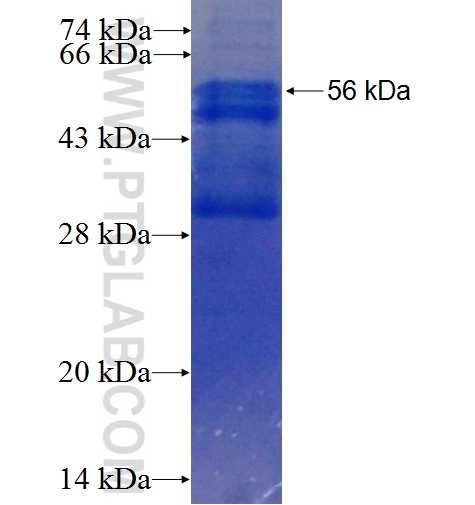 Prohibitin fusion protein Ag1240 SDS-PAGE