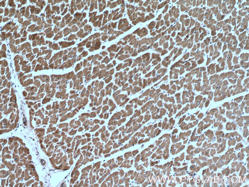 Immunohistochemistry (IHC) staining of human heart tissue using Prohibitin 2 Polyclonal antibody (12295-1-AP)