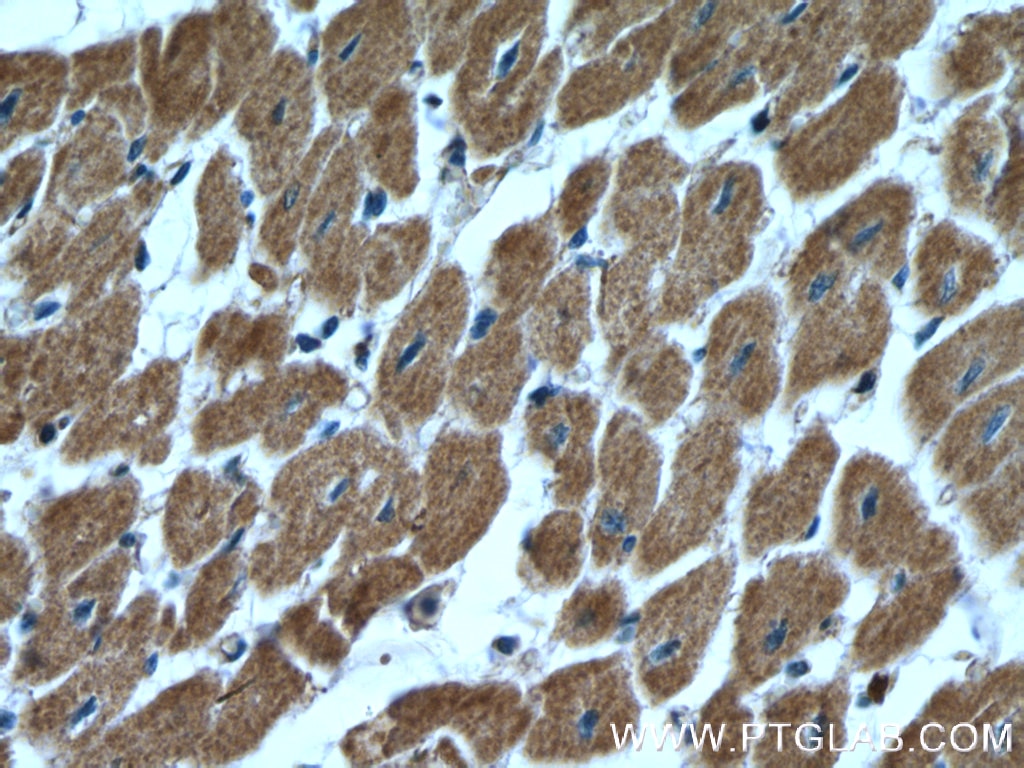IHC staining of human heart using 12295-1-AP