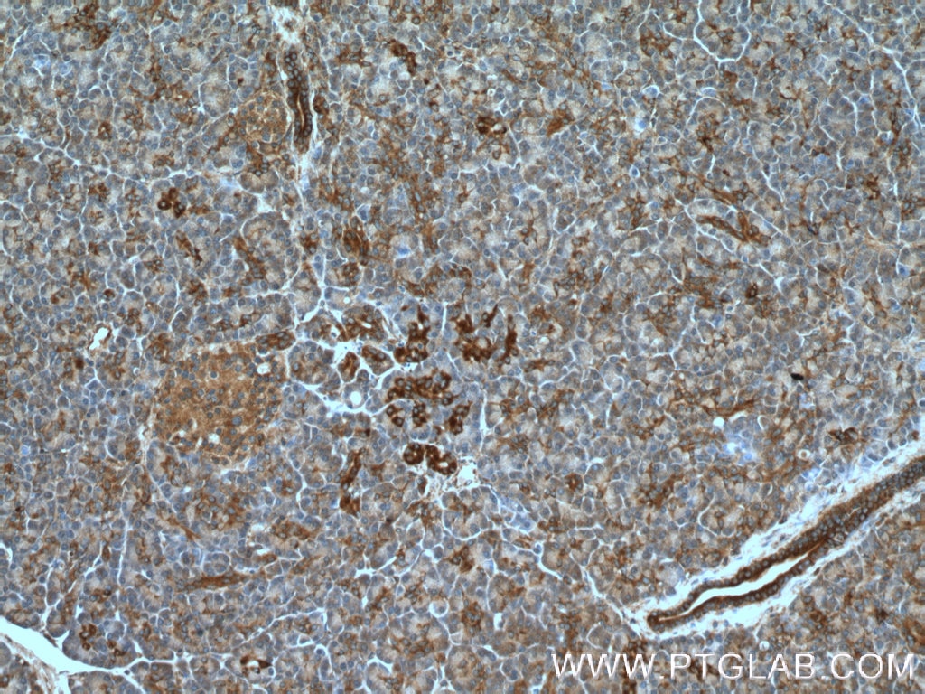 Immunohistochemistry (IHC) staining of human pancreas tissue using Prohibitin 2 Polyclonal antibody (12295-1-AP)