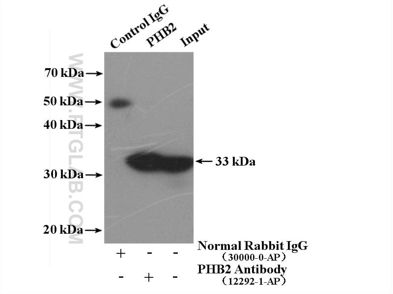 IP experiment of mouse brain using 12295-1-AP