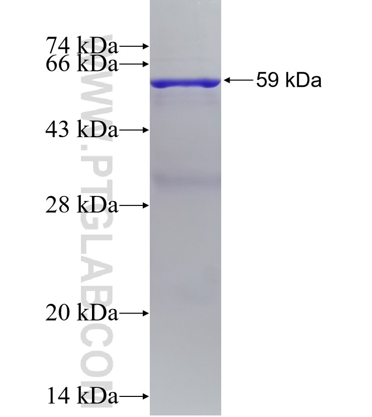 PHB2 fusion protein Ag2977 SDS-PAGE