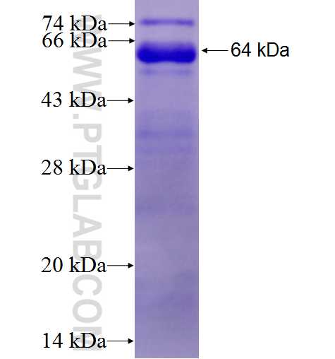 PHC1 fusion protein Ag3304 SDS-PAGE