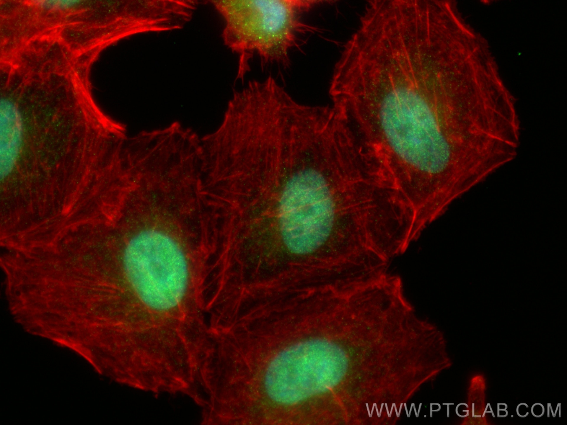 Immunofluorescence (IF) / fluorescent staining of A549 cells using PHC2 Polyclonal antibody (12867-1-AP)