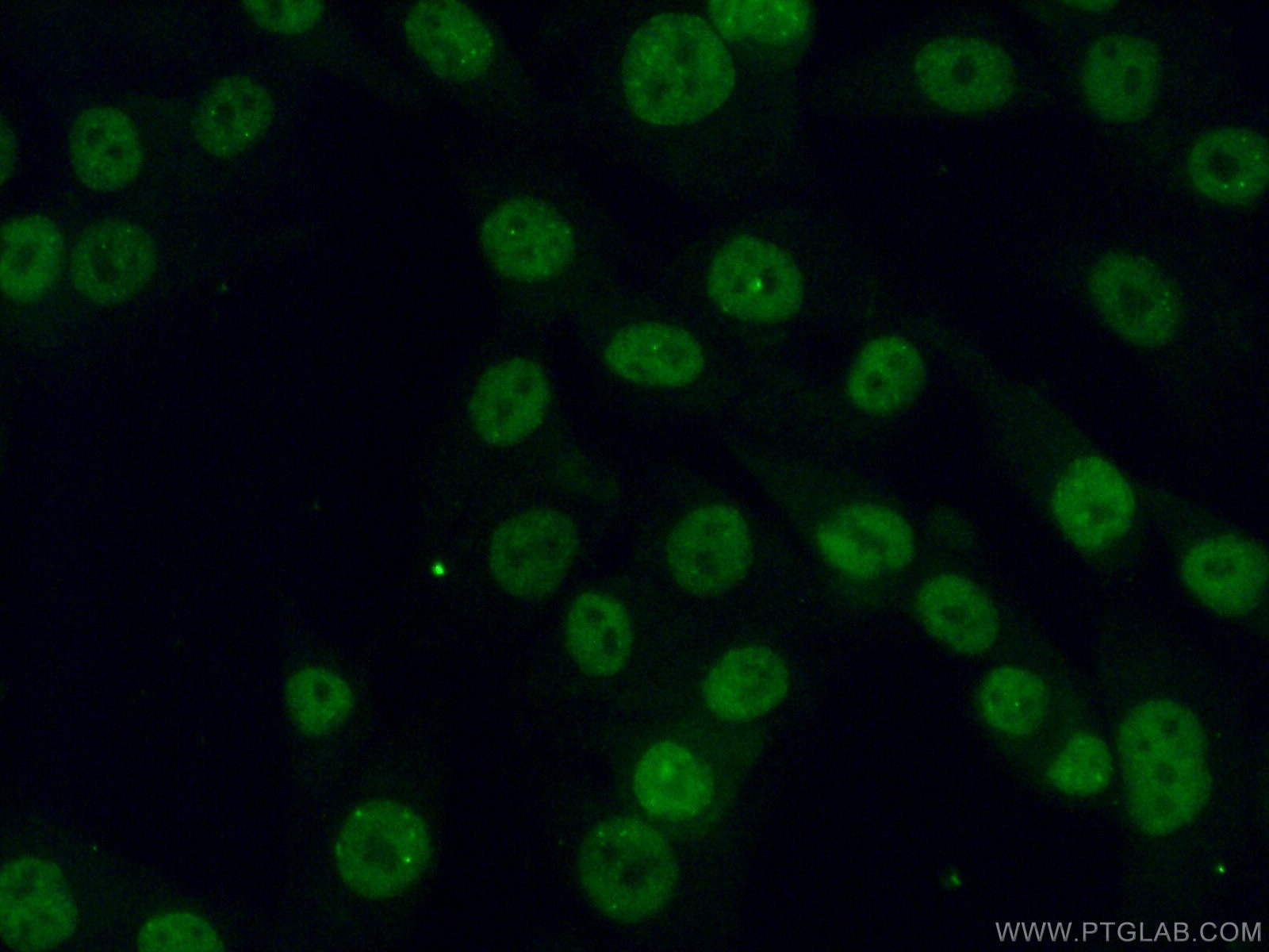 Immunofluorescence (IF) / fluorescent staining of A375 cells using PHC2 Polyclonal antibody (12867-1-AP)