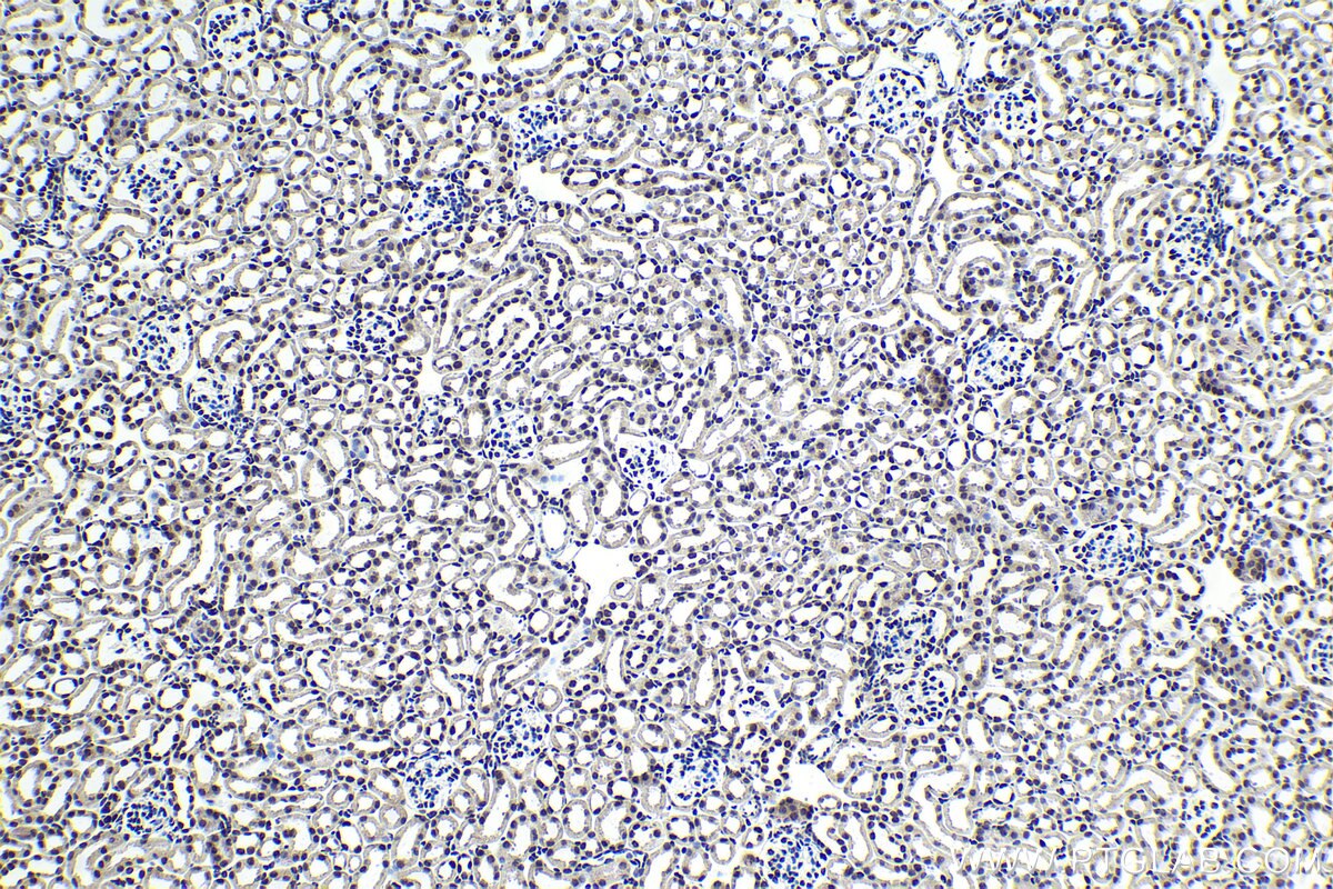Immunohistochemistry (IHC) staining of mouse kidney tissue using PHC2 Polyclonal antibody (12867-1-AP)
