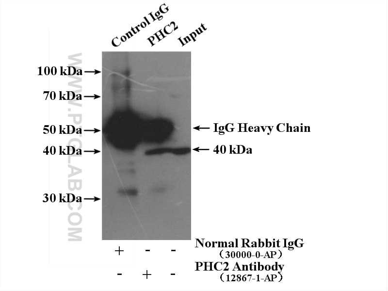 Immunoprecipitation (IP) experiment of HL-60 cells using PHC2 Polyclonal antibody (12867-1-AP)